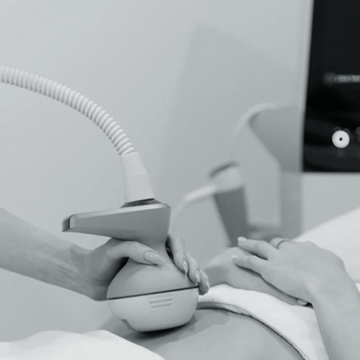 Adana Exion Body